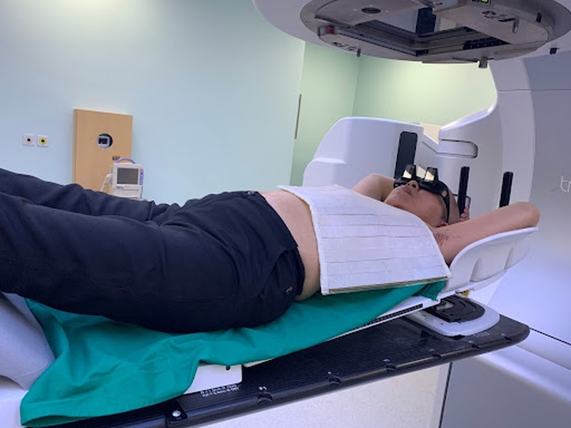 Xạ trị - những vấn đề thường gặp 3