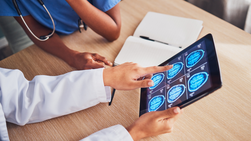 Xạ trị dự phòng não trong ung thư phổi di căn não 1