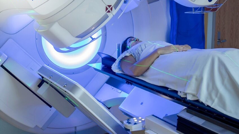 Xạ trị thực quản khi nào được chỉ định? 3