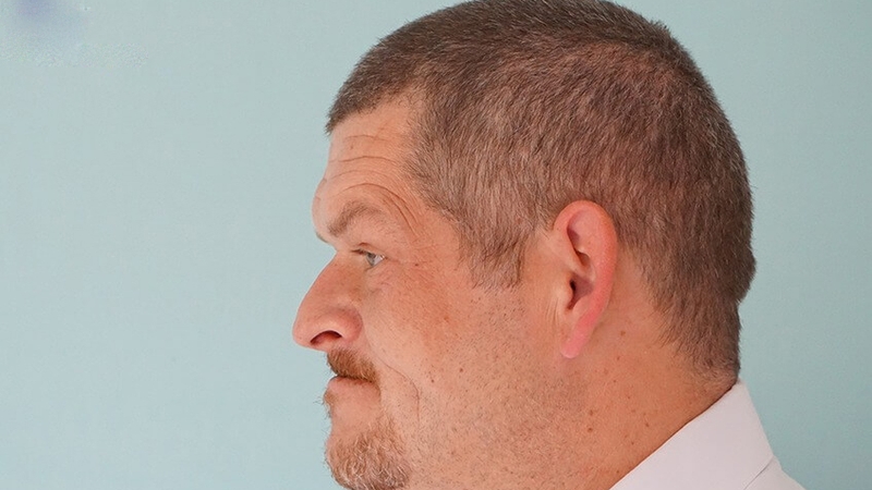 Xạ trị u tuyến yên ác tính và những điều cần biết 2