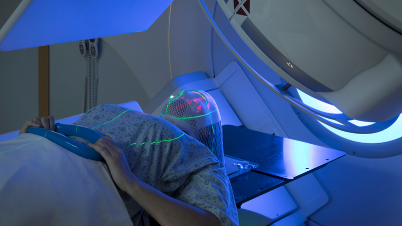 Xạ trị ung thư thực quản và những thông tin quan trọng cần biết 3