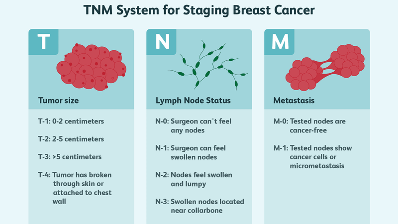 Ý nghĩa xác định giai đoạn của bệnh ung thư 3