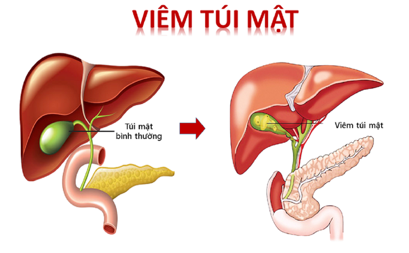 Xác định vị trí huyệt Can Du đúng cách3