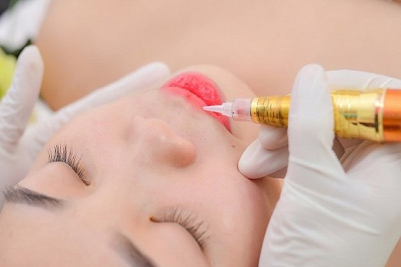 xăm môi ăn bún riêu được không 2