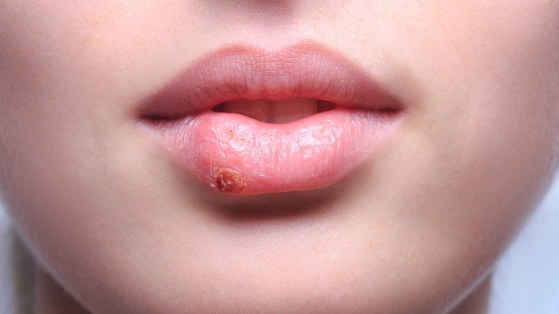 Xăm môi ăn rau nhút được không? Hướng dẫn cách chăm sóc sau khi xăm môi 2