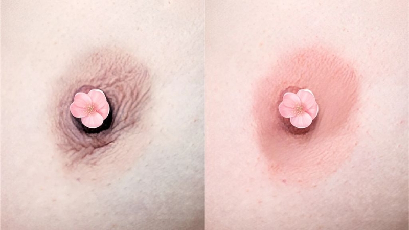 Xăm nhũ hoa: Có nên thực hiện hay không? Cần lưu ý gì? 2