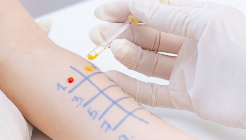 Xét nghiệm 91 dị nguyên: Cách phát hiện và điều trị dị ứng hiệu quả 3