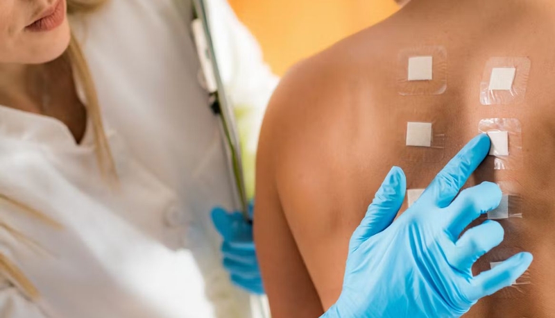 Xét nghiệm 91 dị nguyên: Cách phát hiện và điều trị dị ứng hiệu quả 4