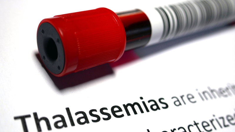 Bệnh tan máu bẩm sinh (Thalassemia) là một nhóm bệnh lý huyết học di truyền phổ biến