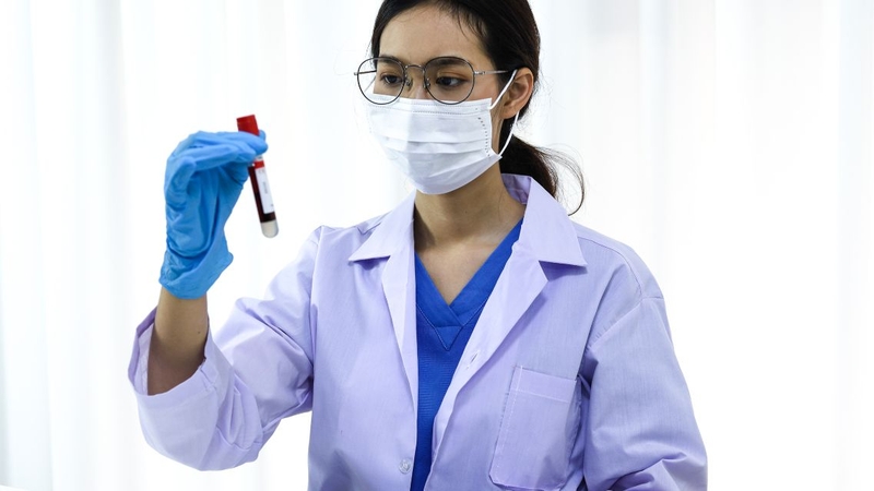 Việc thực hiện xét nghiệm này cần do bác sĩ chỉ định