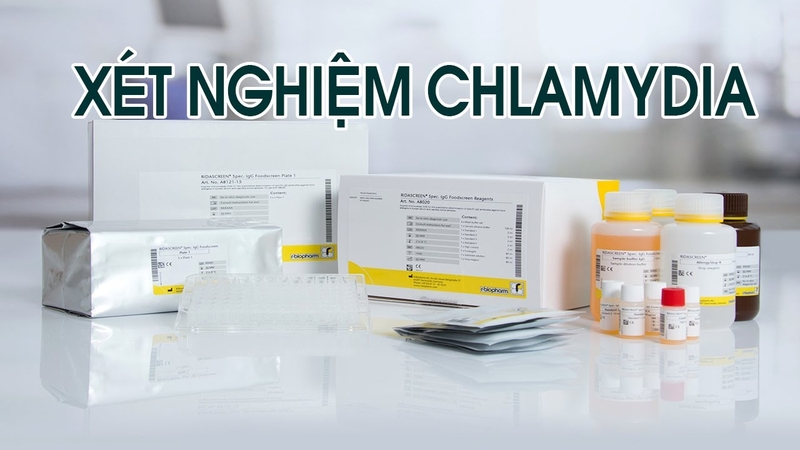 Xét nghiệm Chlamydia là xét nghiệm để tìm vi khuẩn Chlamydia trachomatis trong cơ thể