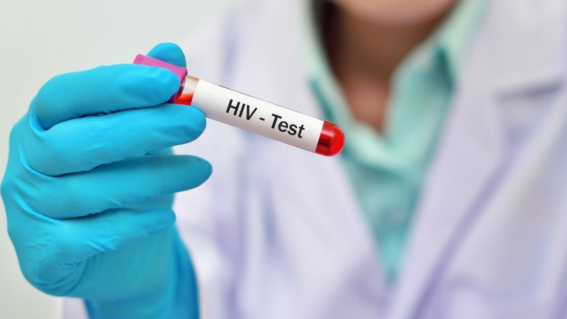 Xét nghiệm HIV Combi PT thời điểm này đã có nhạy khoảng 95 - 98%