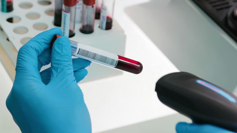 Xét nghiệm NIPT có phát hiện tim bẩm sinh không 2