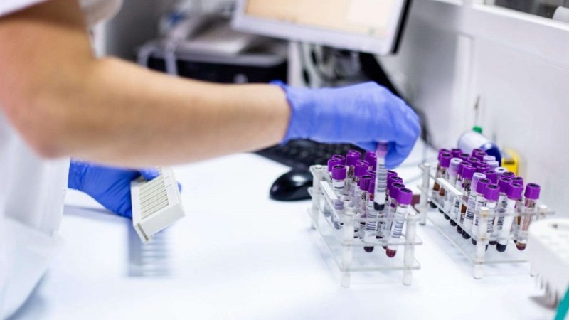 Xét nghiệm RF để chẩn đoán bệnh viêm khớp dạng thấp