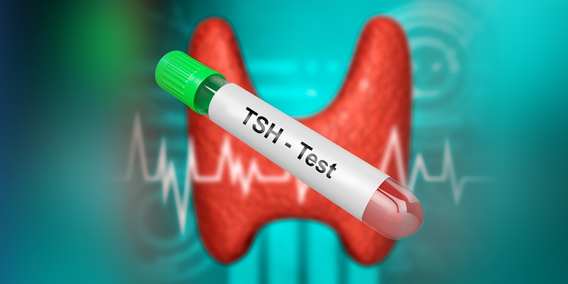 Kết quả xét nghiệm TSH