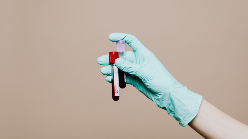 Lấy máu xét nghiệm acid uric là thủ thuật đơn giản, nhanh chóng và an toàn