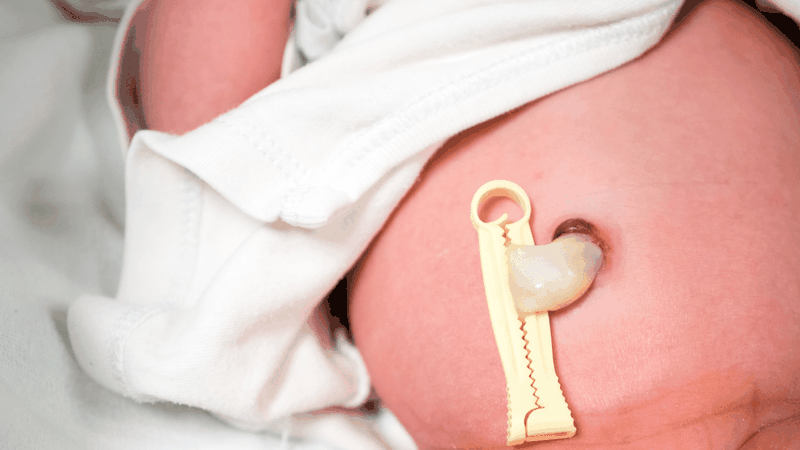 Xét nghiệm ADN bằng cuống rốn tiến hành như thế nào? 3