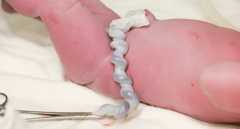 Xét nghiệm ADN bằng cuống rốn tiến hành như thế nào? 1