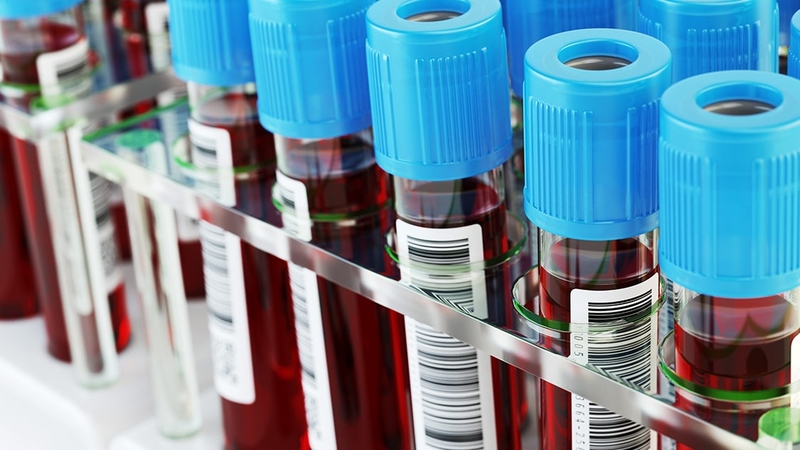 Xét nghiệm ADN bằng máu có chính xác không - Đọc ngay! 1