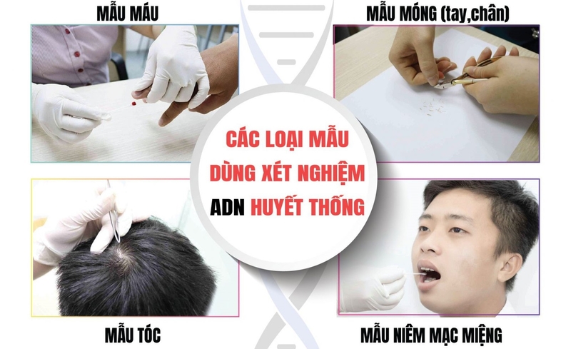 xét nghiệm adn bao nhiêu tiền 2