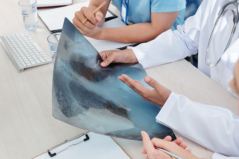 Giá xét nghiệm AFB không cố định, phụ thuộc vào cơ sở y tế và các phương pháp chẩn đoán đi kèm như X-quang,...