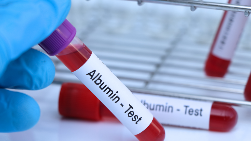 Xét nghiệm albumin bao nhiêu tiền phụ thuộc cơ sở y tế và gói xét nghiệm