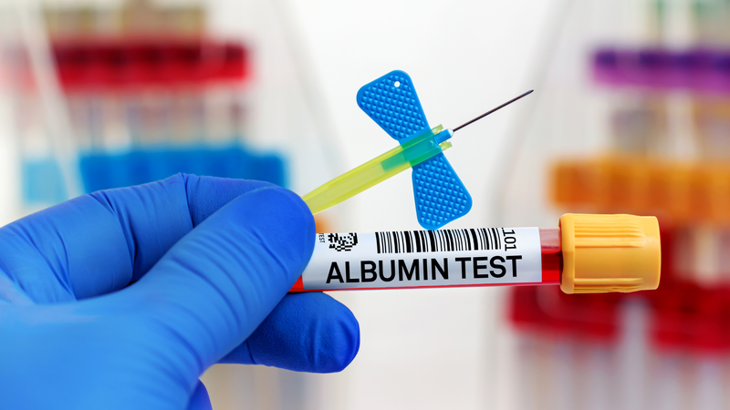 Giá xét nghiệm albumin có thể thay đổi tùy bệnh viện và gói dịch vụ đi kèm