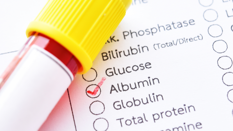 Albumin tăng hoặc giảm có thể là dấu hiệu cảnh báo nhiều vấn đề sức khỏe