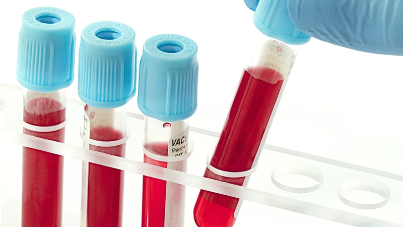 XÉT NGHIỆM AMH CÓ Ý NGHĨA GÌ ĐỐI VỚI SỨC KHỎE SINH SẢN NỮ GIỚI 1