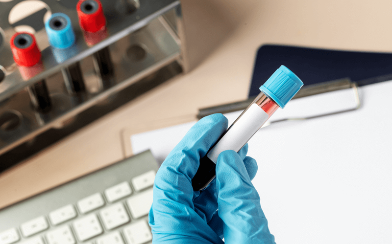 Xét nghiệm ANA là gì? Khi nào cần thực hiện 3