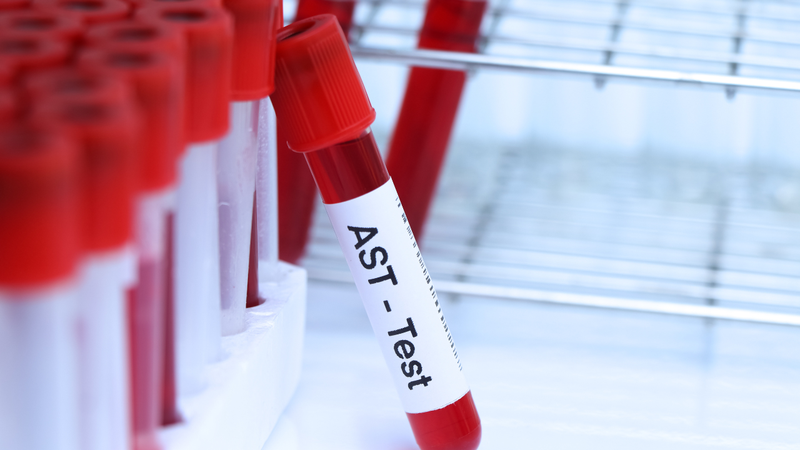 Chi phí xét nghiệm AST có thể thay đổi tùy theo nhiều yếu tố khác nhau
