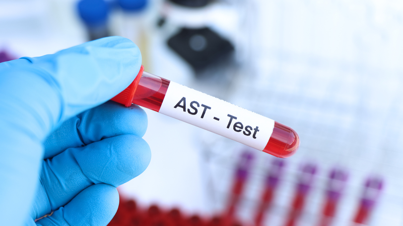 xet-nghiem-ast-la-gi-nhung-ai-nen-thuc-hien (3).png