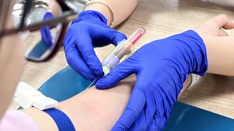 Xét nghiệm bất dung nạp lactose là gì 3