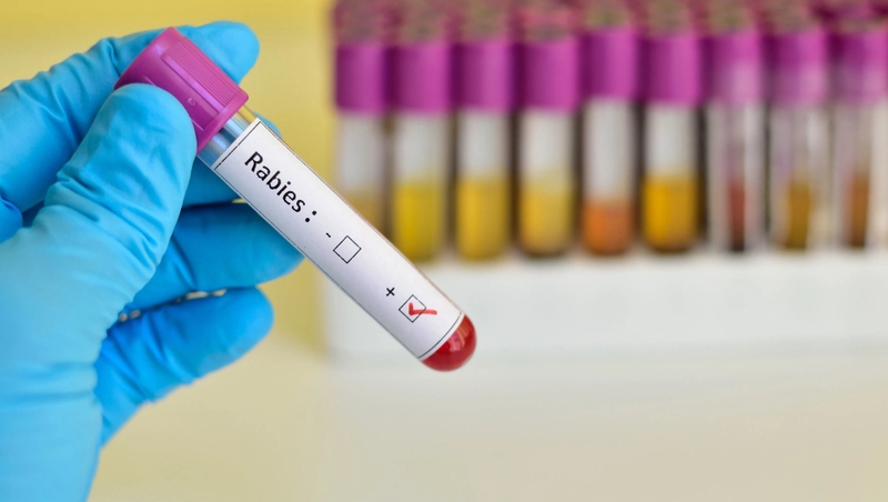 Xét nghiệm bệnh dại ở đâu uy tín và tốt nhất? 4