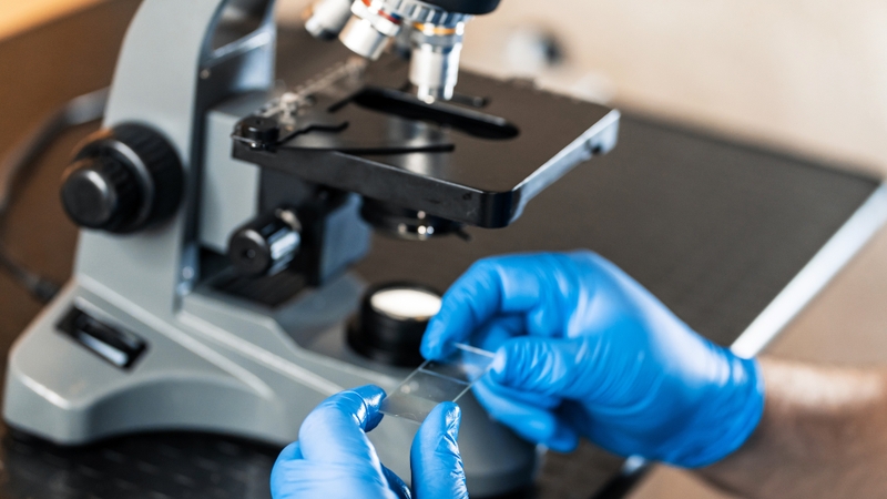 Phương pháp soi tươi sử dụng kính hiển vi để quan sát trực tiếp mẫu bệnh phẩm