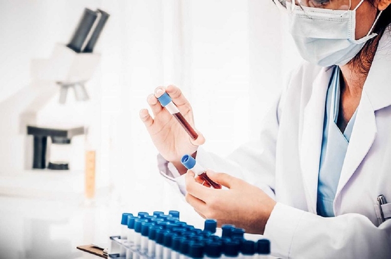 Xét nghiệm Beta2 Microglobulin là gì? Vai trò quan trọng của xét nghiệm 2