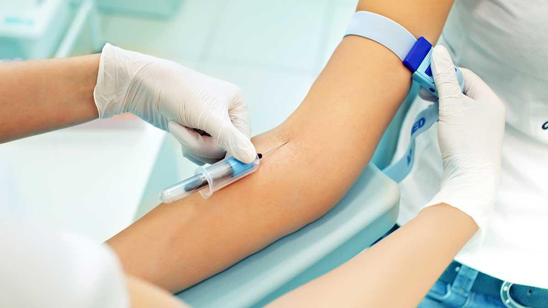 Xét nghiệm Beta2 microglobulin là gì? Ý nghĩa của xét nghiệm Beta2-microglobulin trong chẩn đoán bệnh