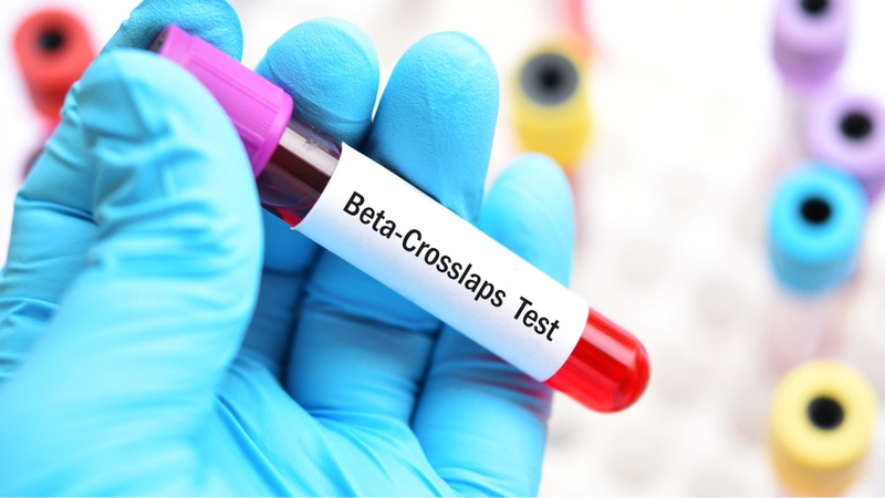 Mức Beta-CrossLaps bình thường dao động khoảng 0,1 - 0,6 ng/mL