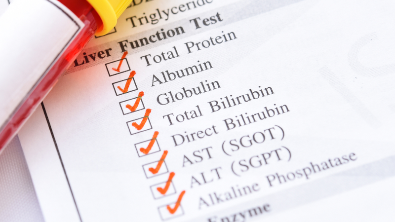Xét nghiệm bilirubin kết hợp với các xét nghiệm khác như men gan (AST, ALT, GGT)