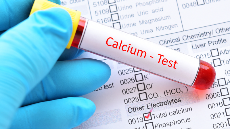 Xét nghiệm Calci ion hóa là gì? Tầm quan trọng của xét nghiệm Calci trong máu 2