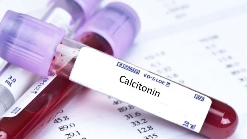 Xét nghiệm Calcitonin và những điều bạn cần biết 4