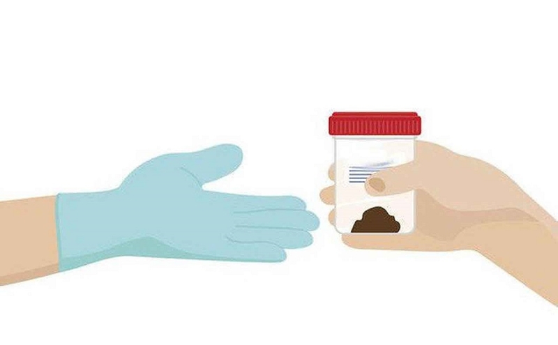 Xét nghiệm Calprotectin là gì? Ý nghĩa của các chỉ số trong xét nghiệm Calprotectin 2