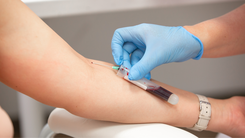 Xét nghiệm Catecholamines trong chẩn đoán y khoa 3