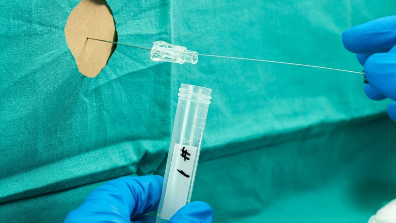 Tìm hiểu chi tiết về phương pháp xét nghiệm cấy dịch não tủy 3