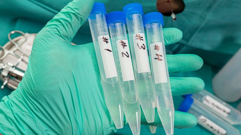 Tìm hiểu chi tiết về phương pháp xét nghiệm cấy dịch não tủy 4