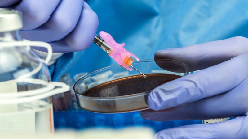 Tìm hiểu chi tiết về phương pháp xét nghiệm cấy dịch não tủy 2