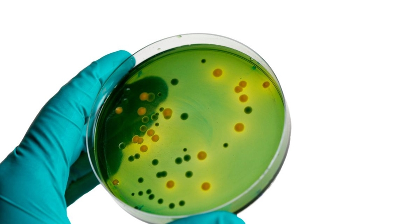 Bác sĩ chỉ định thực hiện xét nghiệm cấy mủ khi tổn thương có mủ kéo dài