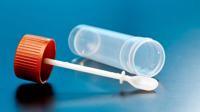 Người bệnh nên lấy mẫu vào giai đoạn sớm của bệnh để dễ phát hiện mầm bệnh