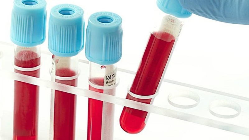 Xét nghiệm Ceruloplasmin: Ý nghĩa và tầm quan trọng trong chẩn đoán bệnh 1