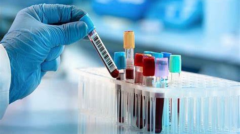 Xét nghiệm Ceruloplasmin: Ý nghĩa và tầm quan trọng trong chẩn đoán bệnh 3